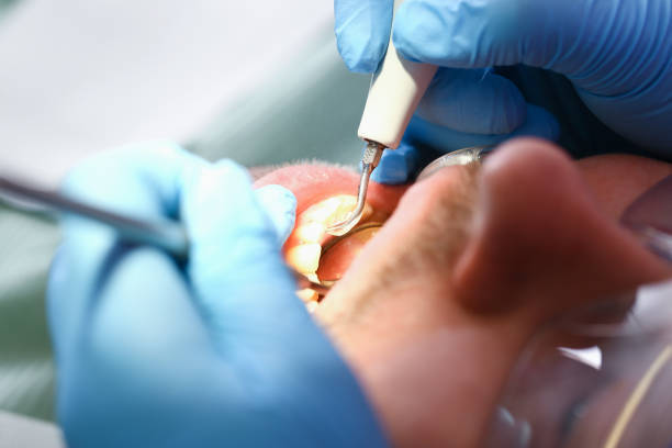 Best Broken or Cracked Tooth Emergency Dentist in Krugerville, TX